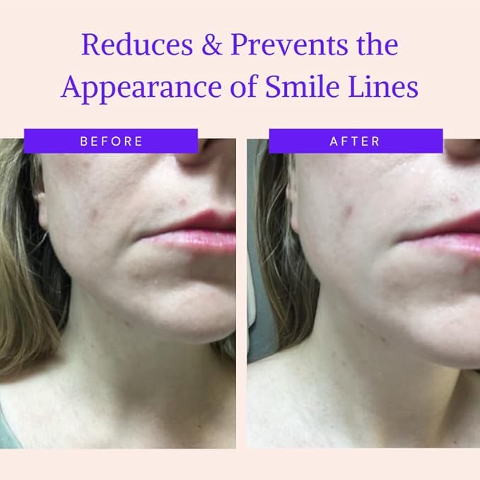 Blumbody face wrinkle patches -