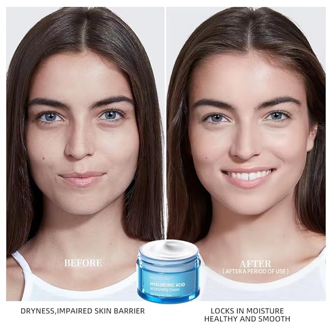 Hydro Boost Hyaluronic Acid Moisturizing Cream, Oil-Free, Suitable for Facial Moisturizers on Dry Skin , Long Iasting Hydro Boost Moisturizing Cream-1.76Oz (white)