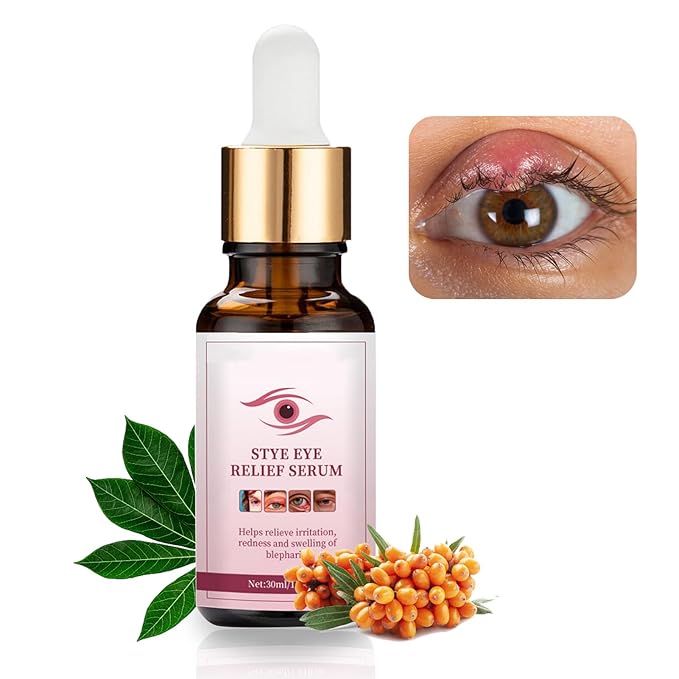 Stye eye treatment,chalazion remover,stye eye
