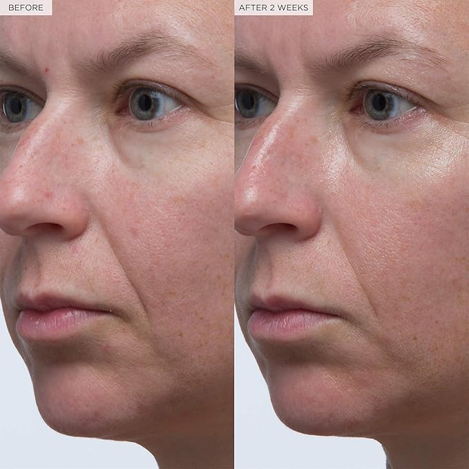 Glow Recipe Plum Plumping & Hydrating Hyaluronic Acid Korean Skin Care Serum - Antioxidant Anti Aging Face Serum + Vitamin B5 for Lasting Skin Barrier Repair & Firming Lines & Wrinkles - Vegan, 30ml