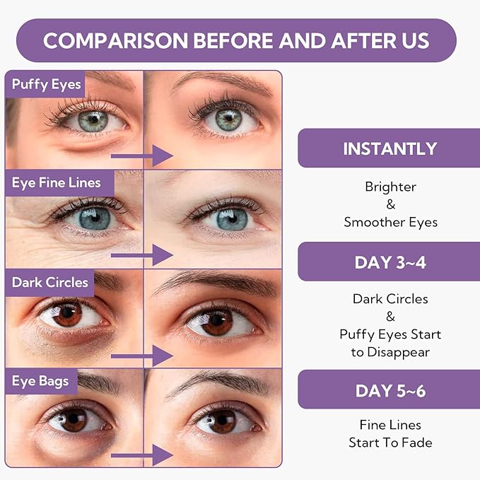 Retinol under eye patches(30 pairs)