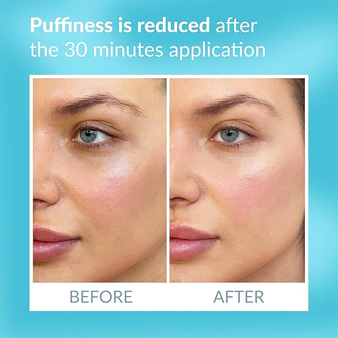 Talika eye therapy patch -