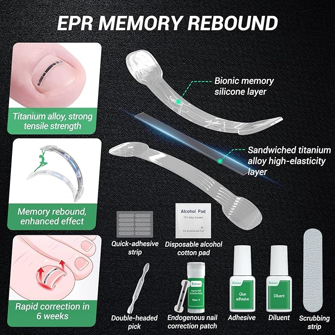 Titanium alloy ingrown toenail treatment