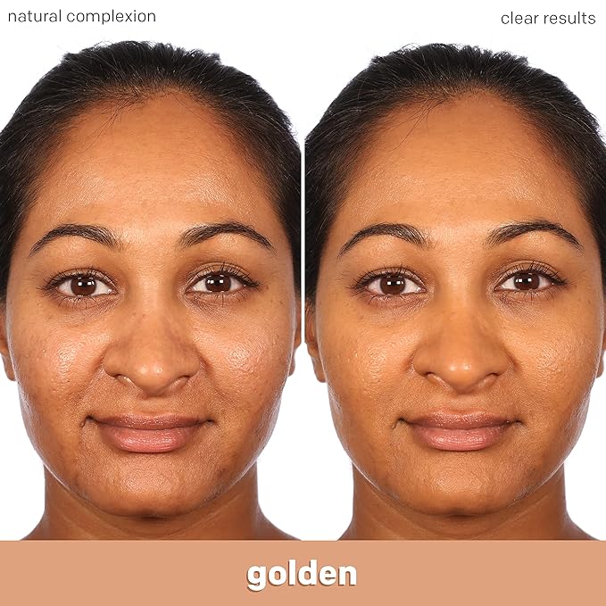 Almay Clear Complexion Acne Foundation Makeup with Salicylic of 2)