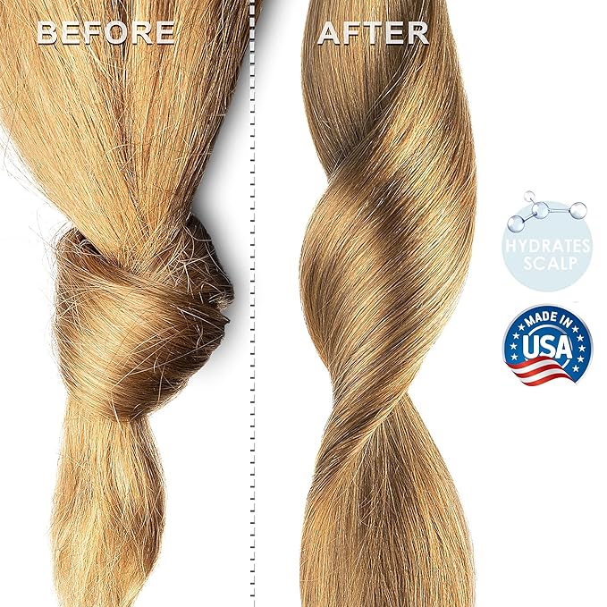 Soapeauty MEADOWFOAM SEED OIL Cold Pressed Unrefined | 100% Pure Natural Meadowfoam Seed Oil for Face & Hair | Moisturizer for Skin, Promotes Hair Growth, Balms | 64 fl oz