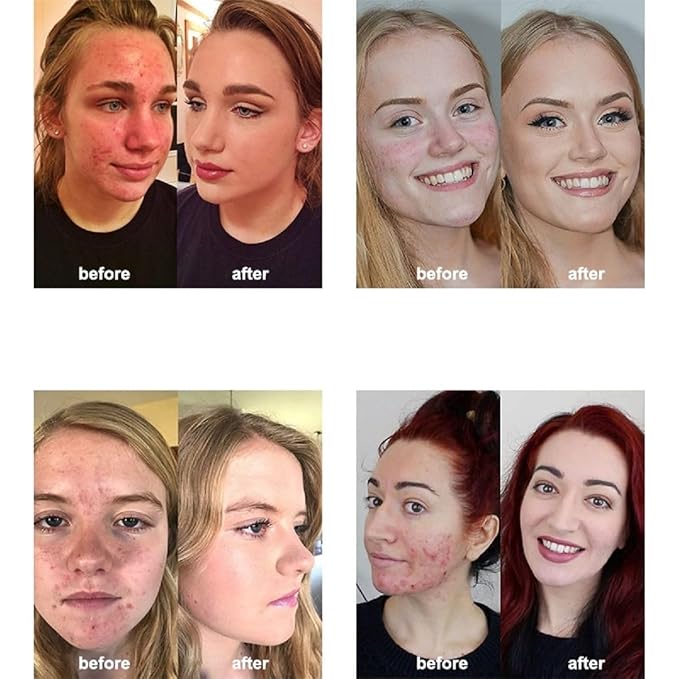 2 Pack PHOERA Foundation 103 Warm Peach Makeup,Full