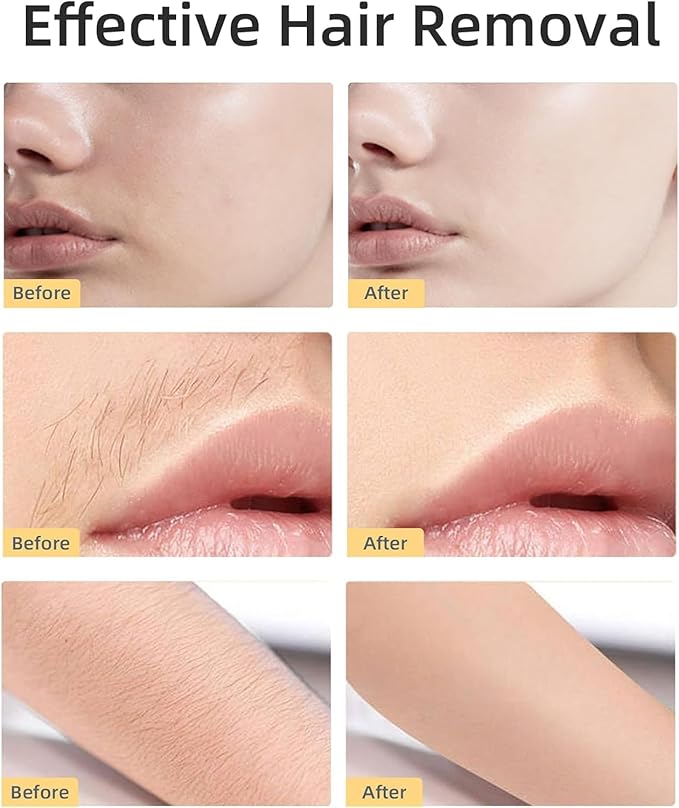 【Generation 2】Facial Hair Remover Replacement Heads for Finishing Touch Flawless Facial Hair Remover, Replacement Blades for Finishing Touch Flawless Gen 2 Hair Removal, 4 Pack (Gold)