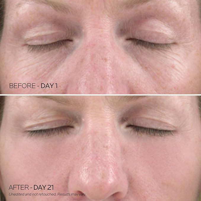 Dr. pure under eye patches