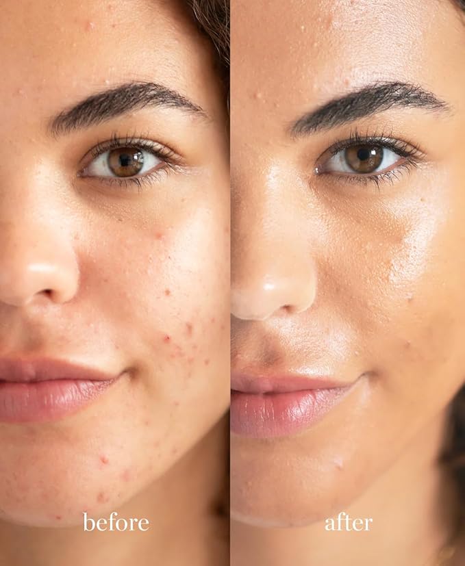 Ere Perez - Natural Lychee Crème Corrector | 0.33 oz