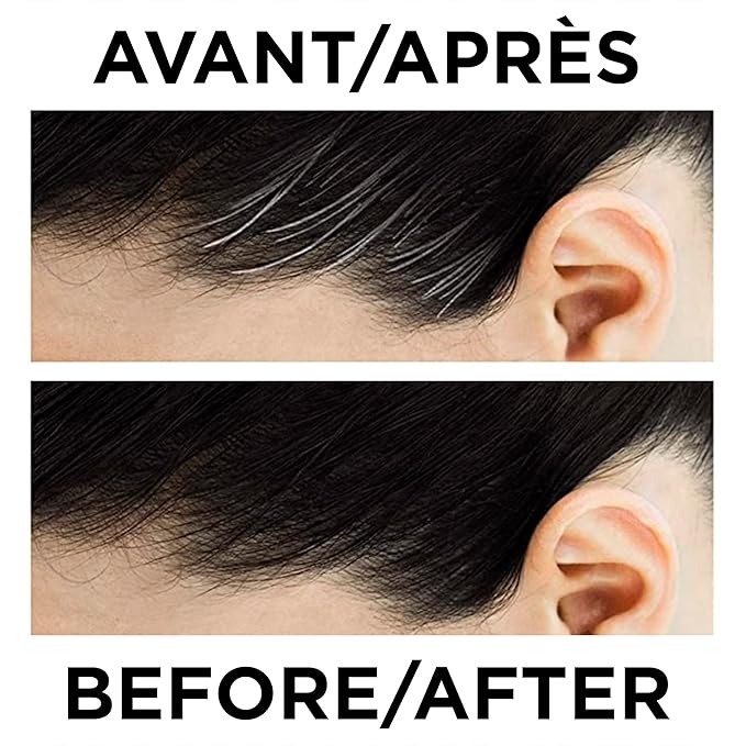 L'Oreal Paris Magic Root Precision