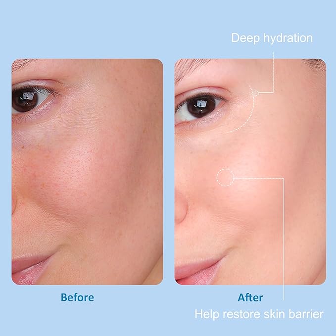 5 Step Skin Care Set, Large Hydrating