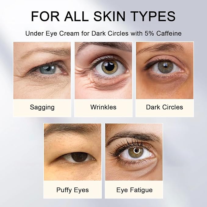 5% caffeine eye cream for