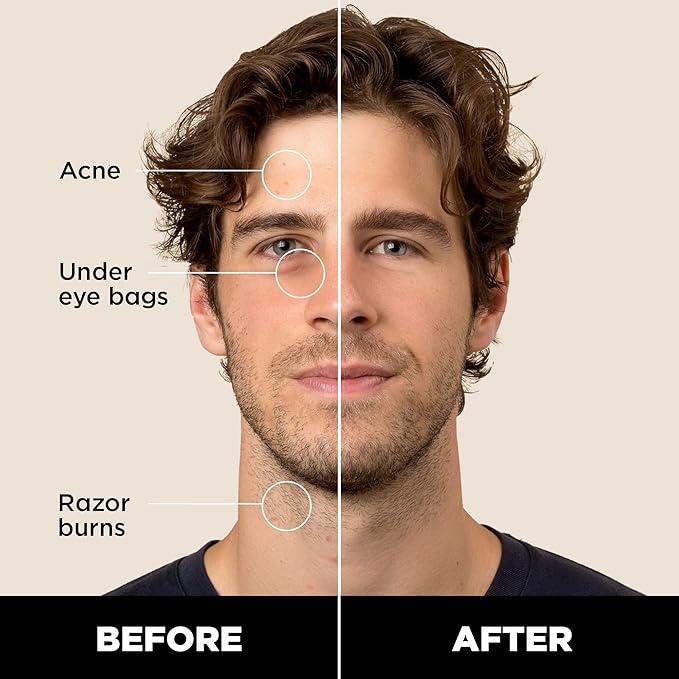 Stryx Concealer Stick Tool for Men, Medium Mahogany Undetectable Coverage