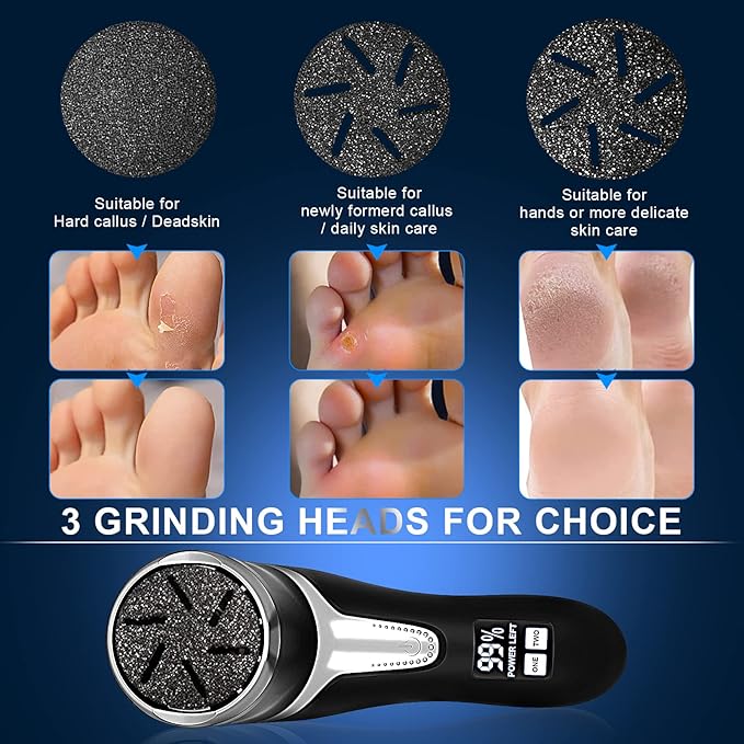 Electric callus remover for feet