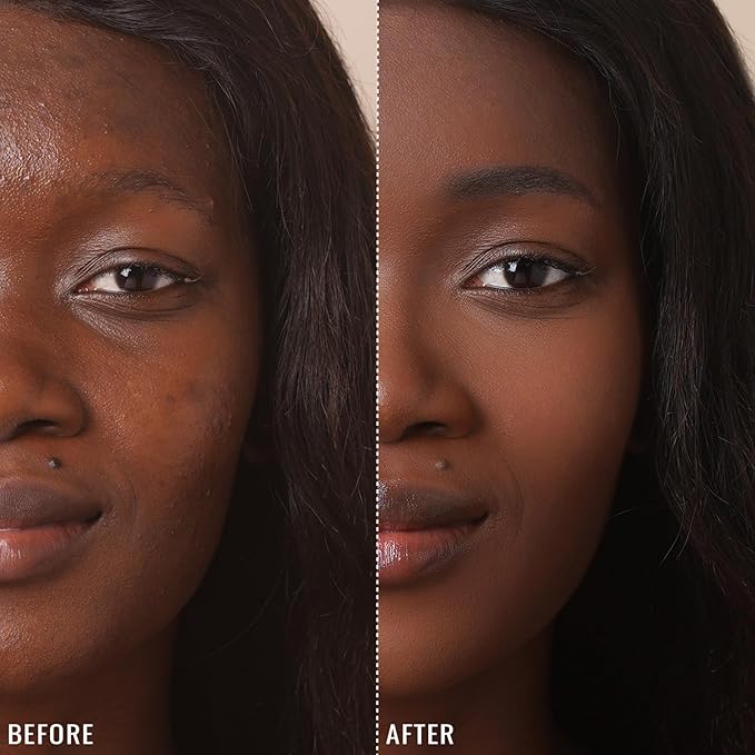 Oulac Concealer Full Coverage, Concealer Stick for Dark W9 Deep 8ml