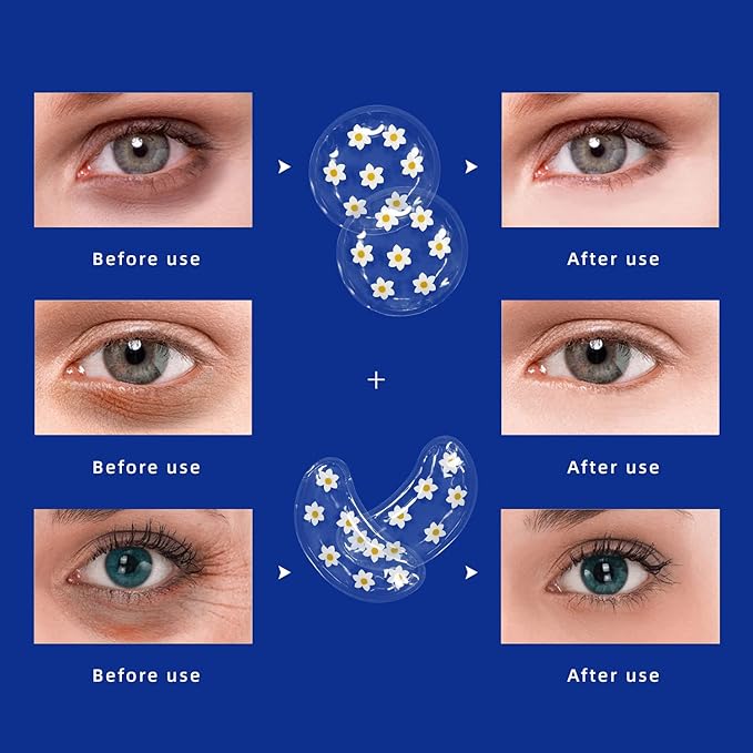 Gel ice pack reusable cooling