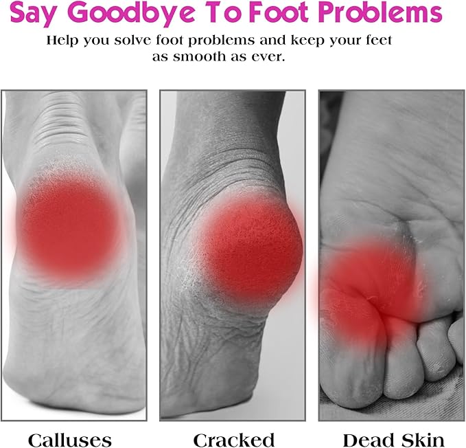 Nano glass foot file callus