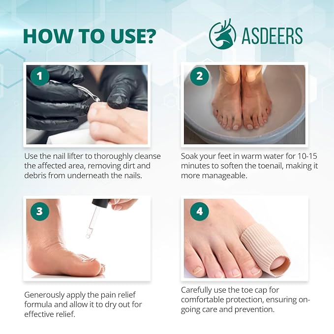 Ingrown toenail treatment: ingrown toenail