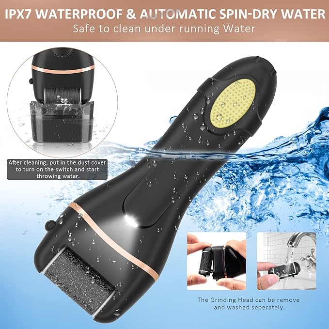 Foot file callus remover for