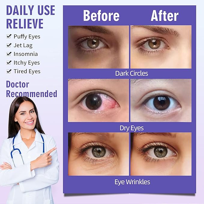 Serfeymi 16 packs steam eye