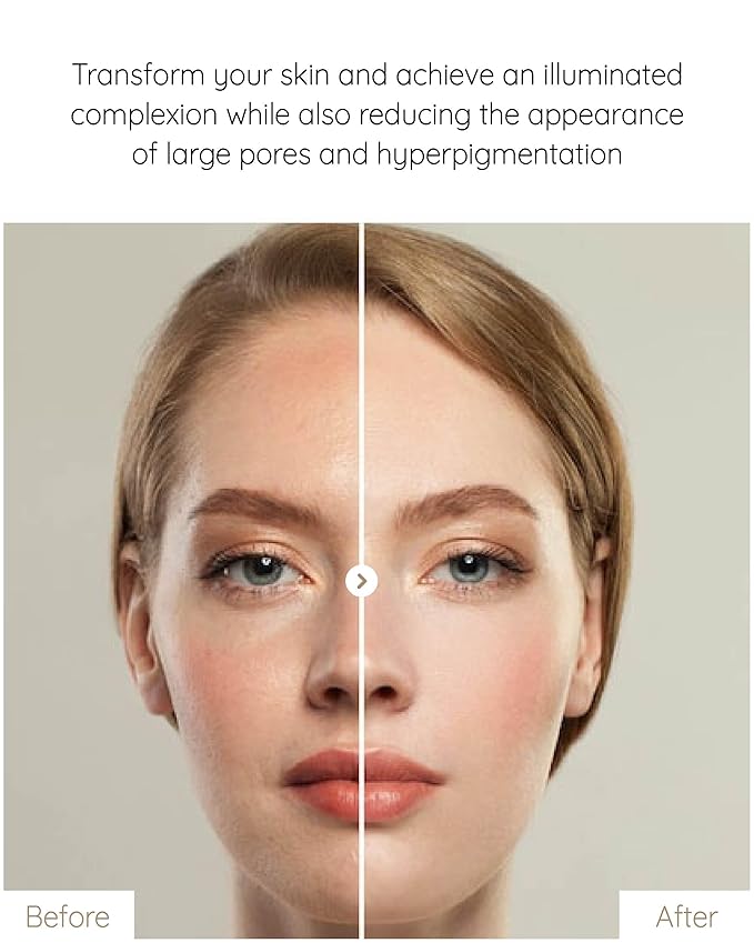 White Mastic Ampoule Sheet Mask (4pc) Ultra-Moisturizing