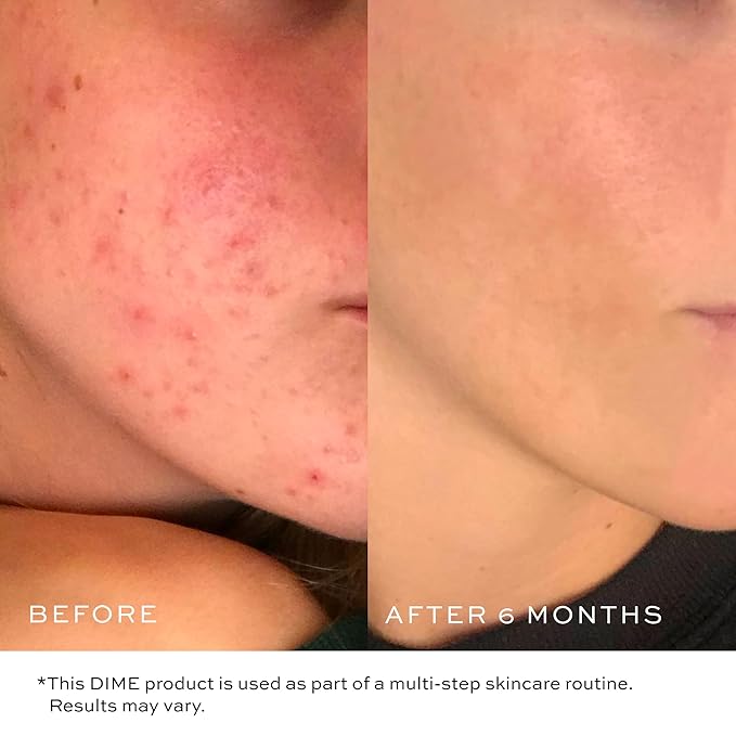 DIME Beauty Gentle Jelly Cleanser, Hydrating