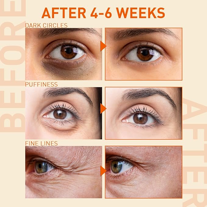 Under eye serum for puffiness: