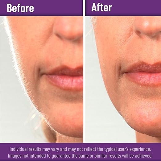 Disposable #15 Scalpel Blades, Sterile Pack of 20 Dermaplaning Blades with Plastic Scalpel Handle, Surgical Knife Scalpel for School Science, High Carbon Steel Dermablade Surgical Blades