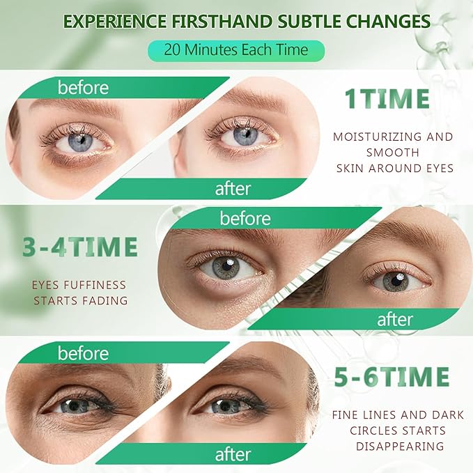 60 pcs green under eye