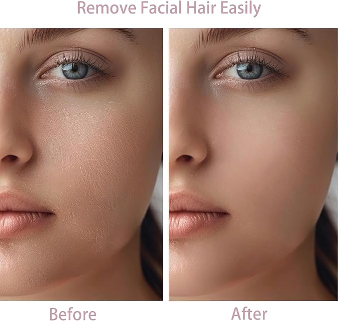 Women Facial Hair Removal Device Battery Operated with 2 Replacement Heads, Ladies Face Shaver for Peach Fuzz Upper Lip, Chin