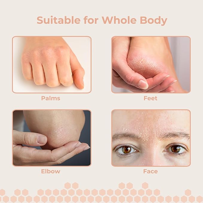 Grass Fed Beef Tallow for Skin Care, Face and Body Moisturizer Cream, Unadulterated Honey, Soothes Dryness, Repairs the Skin Barrier, 2 Oz