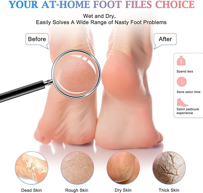 Hofason 4pcs pedicure foot files