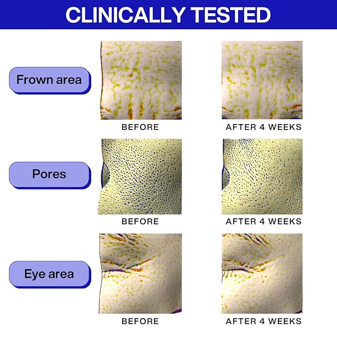 Iope retinol super bounce serum,