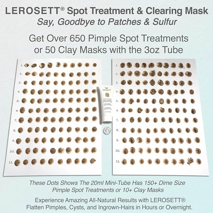 Lerosett facial clay for acne,