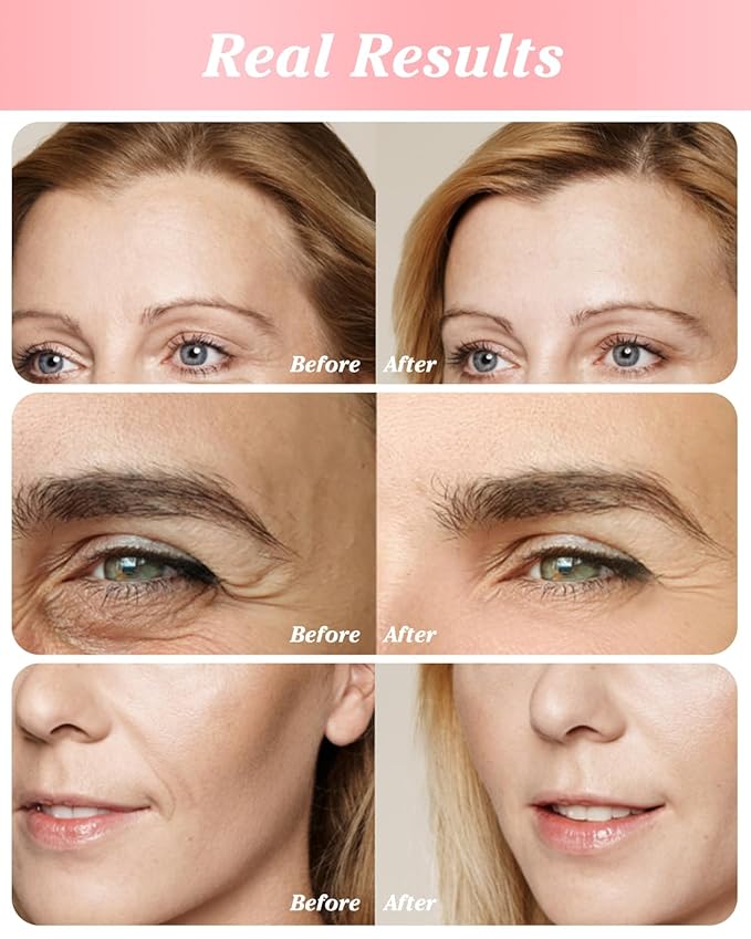 Reusable eye patches for wrinkles