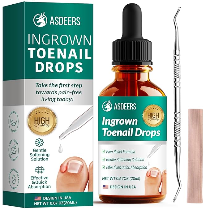 Ingrown toenail treatment: ingrown toenail