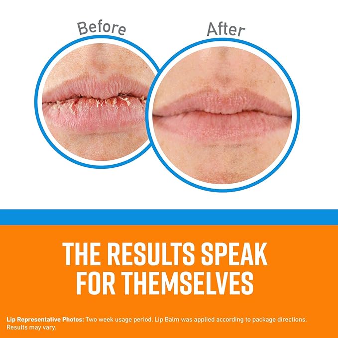 O'Keeffe's Cooling Relief Lip Repair Lip