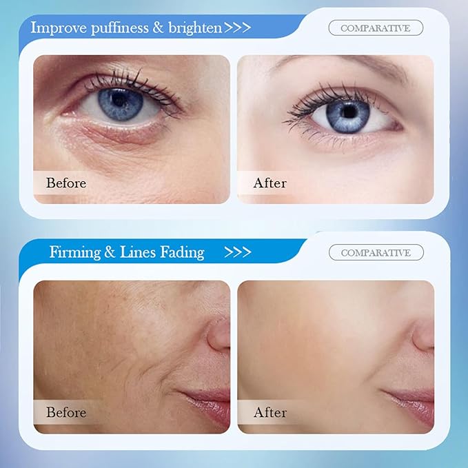 8D Hyaluronic Acid Face Care Set, Hydrating