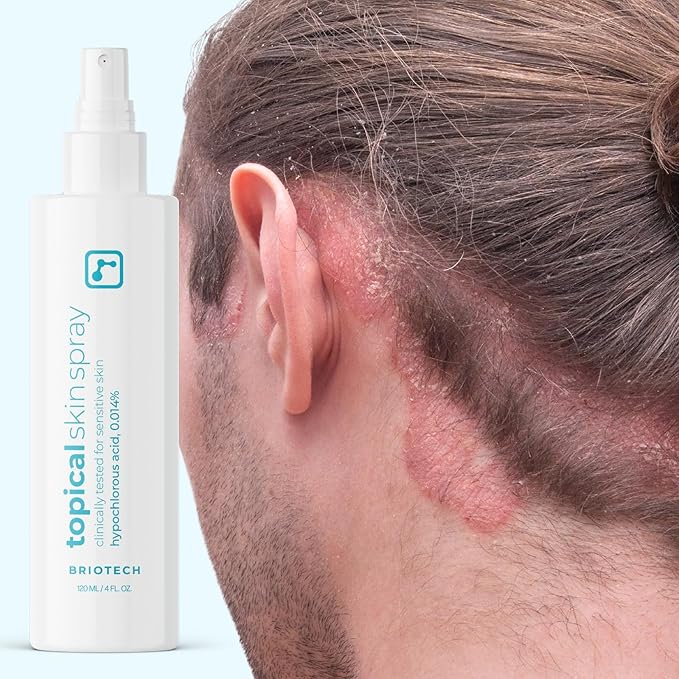 BRIOTECH Topical Skin Spray, Hypochlorous Acid Spray for Body & Face, Eyelid Cleanser, HOCl Facial Mist, Support Against Irritation, Calm Redness, Soothe Foot & Scalp, 128 fl oz (4 Pack)