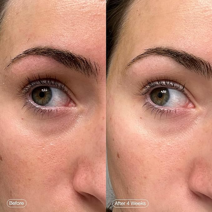 Topicals faded brightening under eye