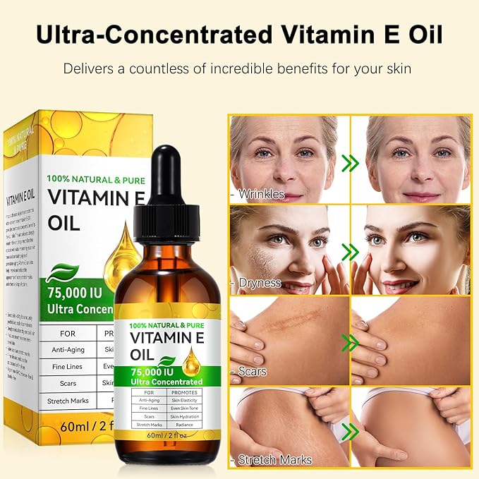 2PCS Natural Vitamin E Oil for Skin, 75,000 IU Ultra Concentrated Vitamin E Oil for Face, Hair and Scars, Moisturizing Dry Skin Oils, Promotes Skin Elasticity