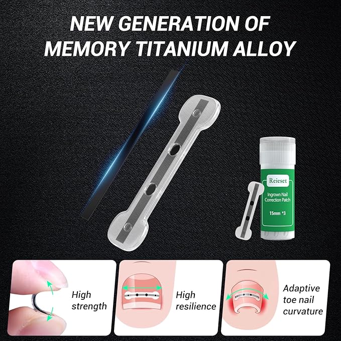 Titanium alloy ingrown toenail treatment