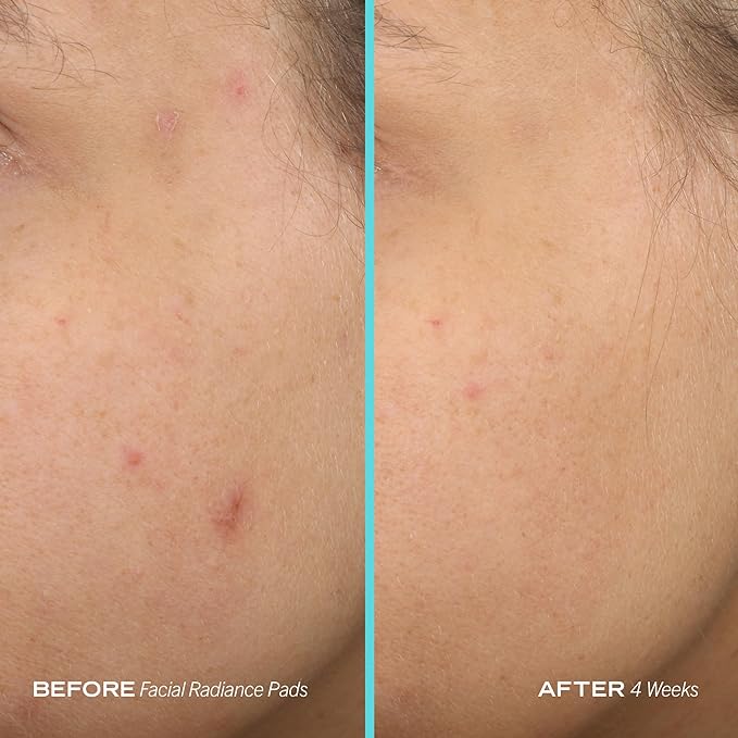 First aid beauty facial radiance