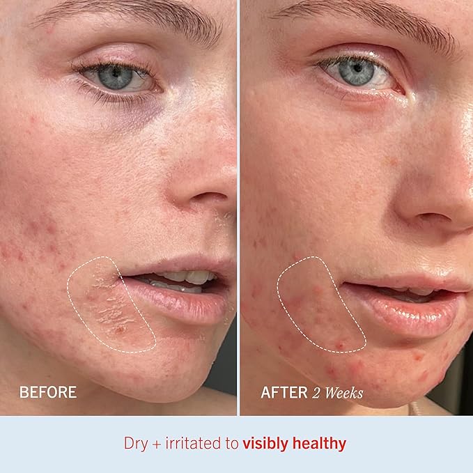 First Aid Beauty - Ultra Repair Cream, Intense Hydration Whipped Colloidal Oatmeal, Strengthens Skin Barrier in 7 Days & Helps Relieve Eczema, Luxury Face & Body Moisturizer, Grapefruit Scent, 12 oz