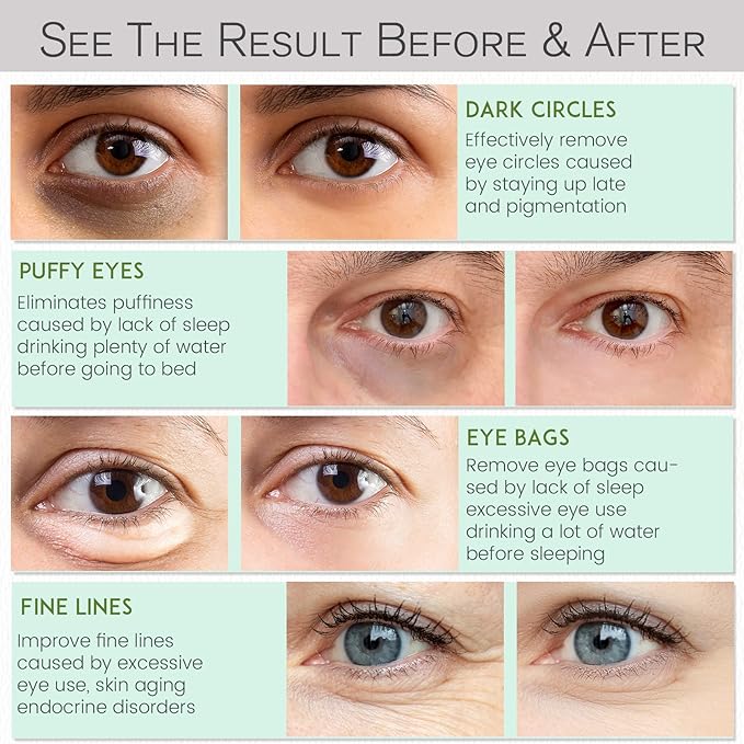 Under eye patches for dark