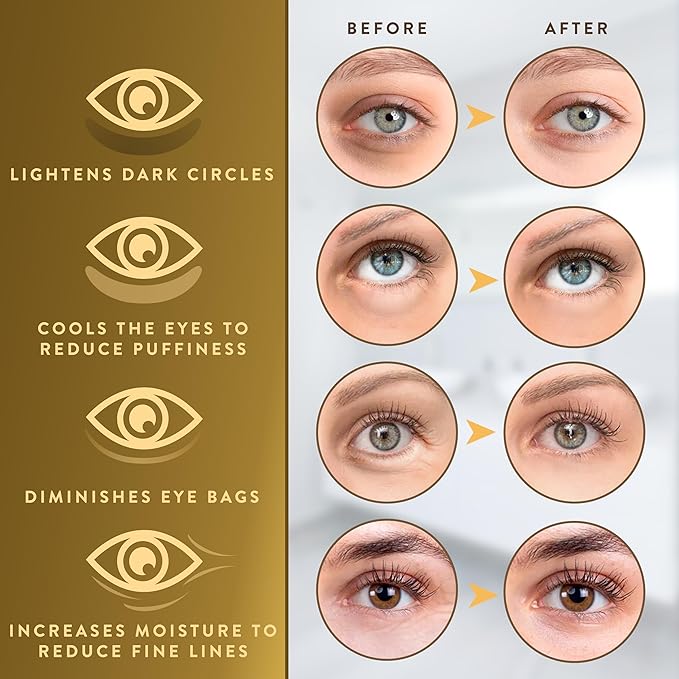 Patchrx 24k gold under eye