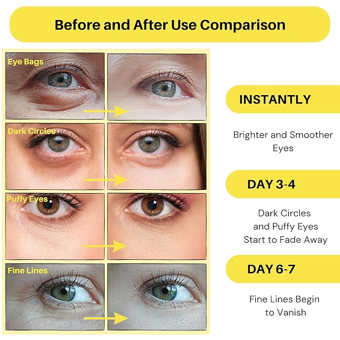 Under eye patches - 60