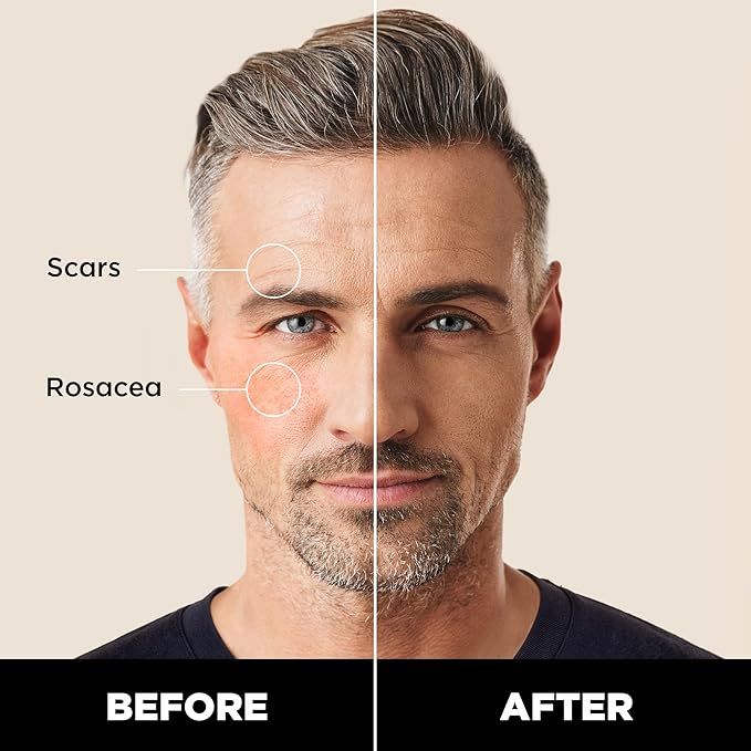 Stryx Concealer Stick Tool for Men, Light Cognac Skin Tones