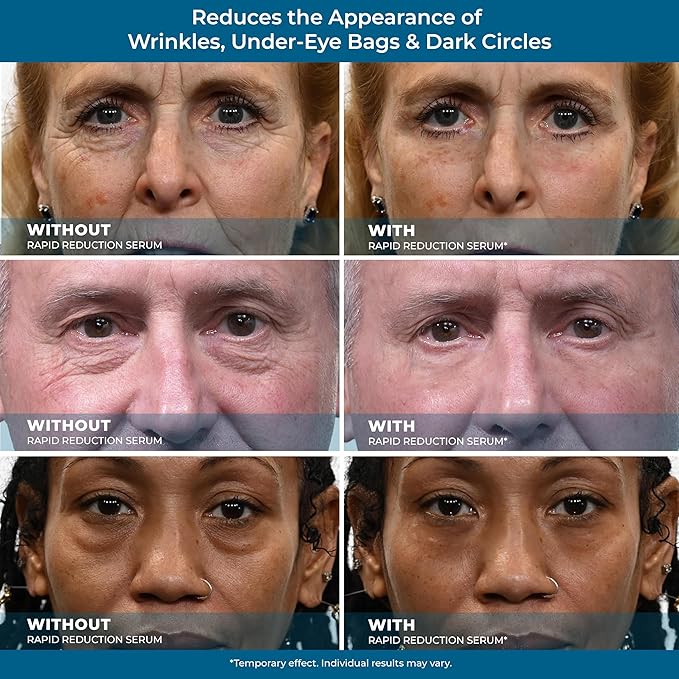 Plexaderm rapid reduction eye serum